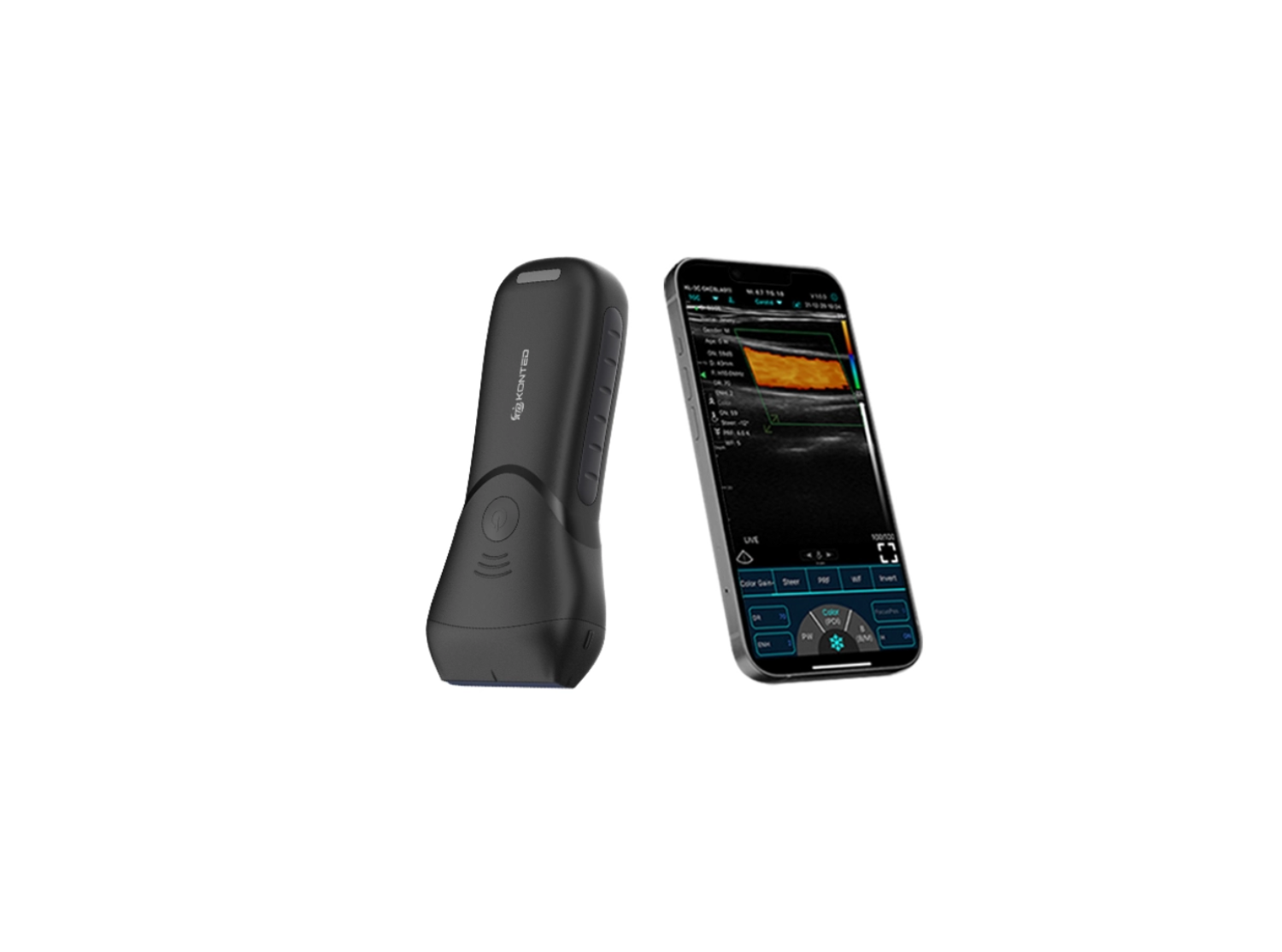 Lineer El Tipi Kablosuz Ultrason